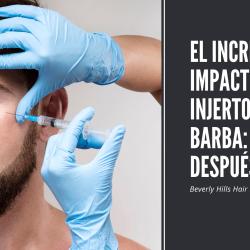 Factors Influencing Beard Implants Prices: