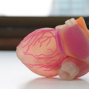 Artificial Organs Market Artificial Organs Market