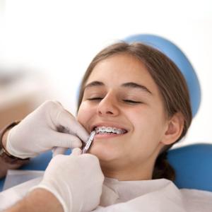 Braces and Self-Ligating Braces: Benefits of Advanced Technology