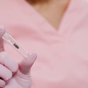 Understanding the Lifespan of Dental Implants: What to Expect