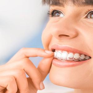 Teeth Veneers: A Solution for Stained, Chipped, or Misaligned Teeth