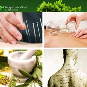 What is acupuncture, and how does it help to have good health