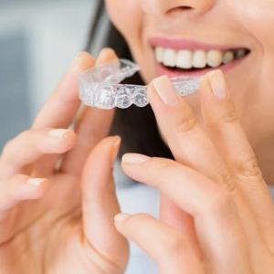 How Invisible Braces Work: A Step-by-Step Guide