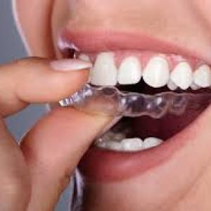 How to Choose the Best Clear Aligner Provider