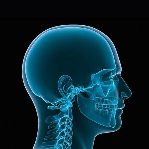 Craniomaxillofacial (CMF) Devices Market Share, Size, Latest Trends and Forecast 2024-2032