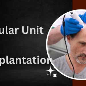 10 Reasons to Consider Follicular Unit Hair Transplantation