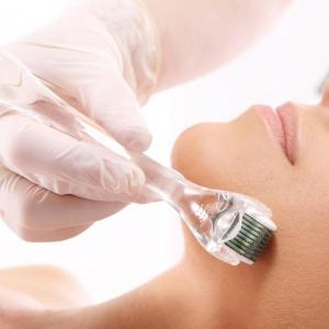 Know how much does microneedling cost? 
