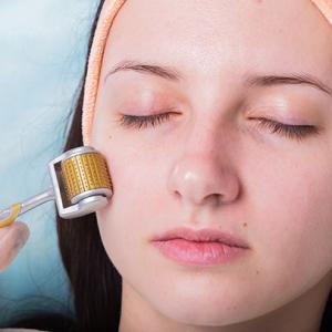 How to find accurate microneedling costs and its benefits?