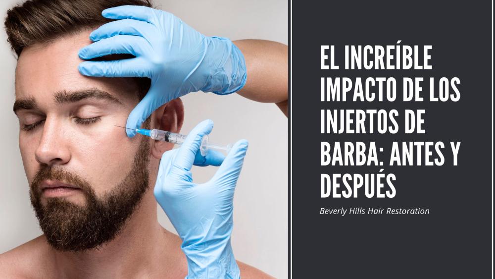 Factors Influencing Beard Implants Prices: