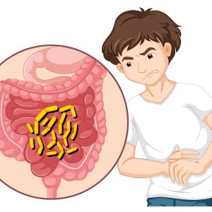 Necrotising Enterocolitis Market Size, Trends, and Growth Opportunities 2026-2033