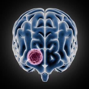 Neuroendocrine Tumors Market Size, Growth, and Strategic Insights 2026-2033