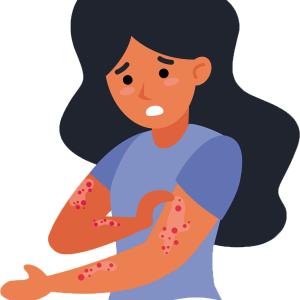 Plaque Psoriasis Market Size, Trends, and Growth Forecast 2026-2033