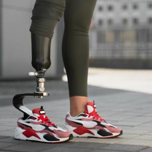 Global Robotic Prosthetics Market Size, Trends, and Growth Forecast 2026-2033