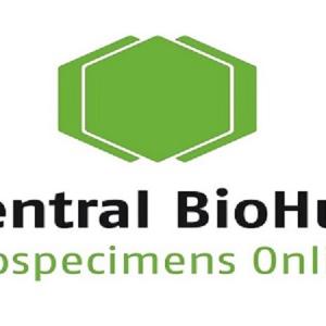 Central BioHub offers Hard to find sepsis research samples