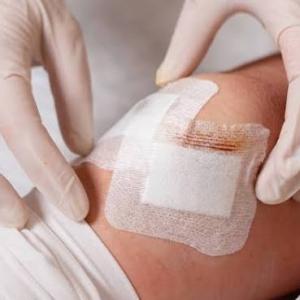 Wound Dressing Market Size, Trends, and Growth Opportunities 2026-2033