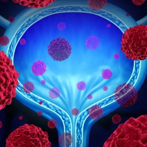 Urothelial Cancer Treatment Market Application, CAGR Status, Growth 2024-2032