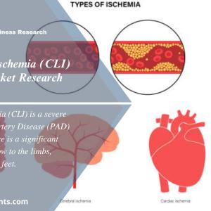 Critical Limb Ischemia Treatment Market Size, Share 2024-2032