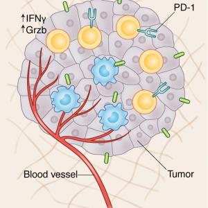 Tumor Infiltrating Lymphocytes Market  Research Report and Forecast to 2027 | Research Informatic