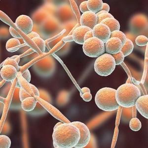  Candidiasis Crisis: Exploring the Escalating Problem of Fungal Infections