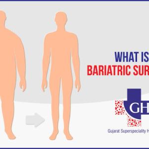 What is Bariatric Surgery? What are the Different Types of Bariatric Surgery