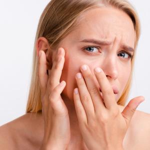 Is It Dry Skin or Eczema? How to Tell the Difference