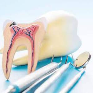 Hidden Costs of Root Canal Treatment: What Patients Should Know