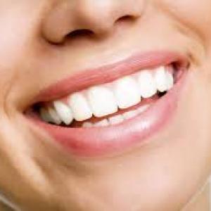 Teeth Whitening and Lifestyle Choices: Impact on Oral Health