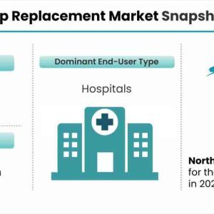 Hip Replacement Market Size to Expand Significantly by the End of 2028