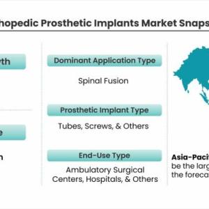 Orthopedic Prosthetic Implants Market Set to Experience Phenomenal Growth from 2021 to 2026