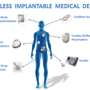 Medical Device Connectivity Market  Forecast, Analysis And Supply Demand 2027