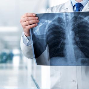 Radiology Services Market Latest Trends, Development, Revenue, Demand And Forecast To 2027