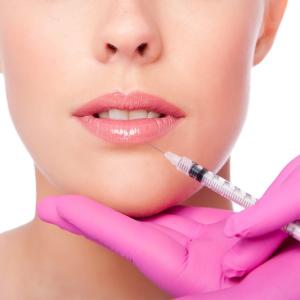 Lips Fillers: What to Expect, Types, Benefits & Side Effects