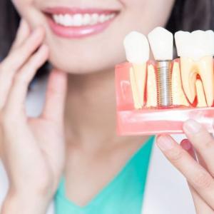 What are the 3 types of dental implants