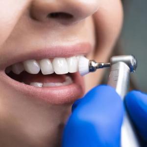 How Often Should You Schedule Dental Cleaning