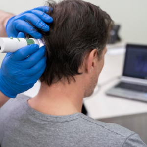 Hair Transplant Recovery Time – What to Expect?