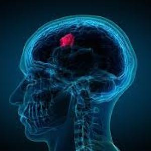 Meningioma Market Share 2023 | Forecast till 2033