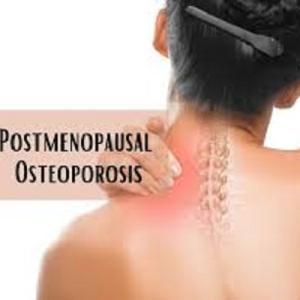 Post Menopausal Osteoporosis Market Growth | Report, 2023-2033