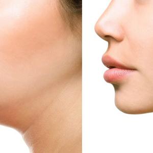 What You Should Know about Post-op Care for Neck Liposuction 