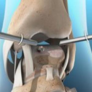Find Steadfast Knee Surgeries With The Right Doctor 
