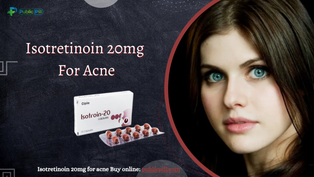 Which medicine is best for acne and acne scars?
