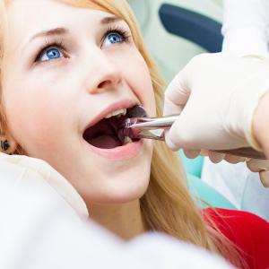 The Role of Sedation in Wisdom Tooth Removal: What Are Your Options?