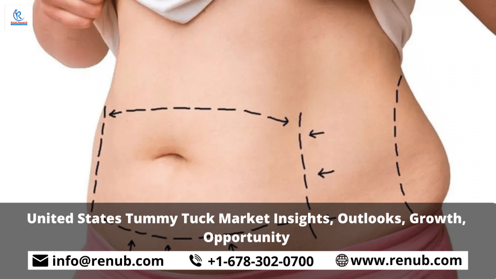 United States Tummy Tuck Market Insights, Outlooks, Growth, Opportunity