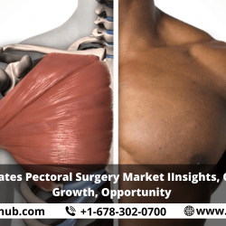 United States Pectoral Surgery Market Insights, Outlooks, Growth, Opportunity