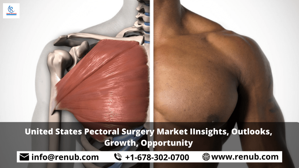 United States Pectoral Surgery Market Insights, Outlooks, Growth, Opportunity