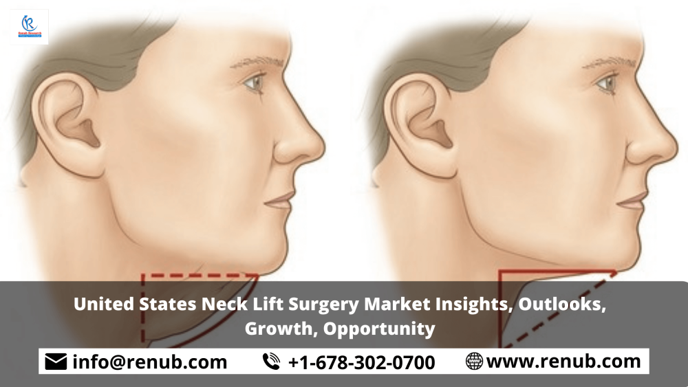 United States Neck Lift Surgery Market Insights, Outlooks, Growth, Opportunity