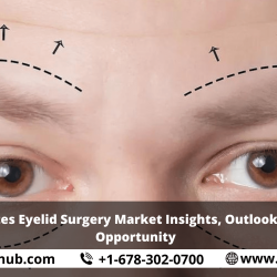 United States Eyelid Surgery Market Insights, Outlooks, Growth, Opportunity