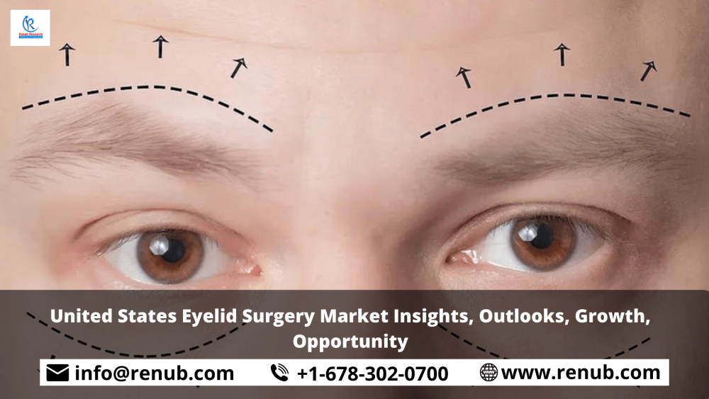 United States Eyelid Surgery Market Insights, Outlooks, Growth, Opportunity