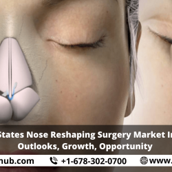 United States Nose Reshaping Surgery Market Insights, Outlooks, Growth, Opportunity