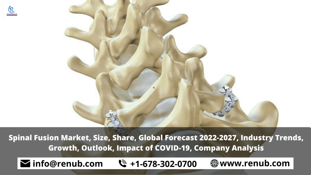 Spinal Fusion Market, Share, Industry Trends, Growth, Size, Overviews, Global Forecast 2022-2027