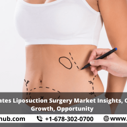 United States Liposuction Surgery Market Insights, Outlooks, Growth, Opportunity